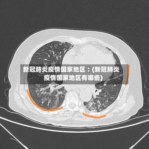 新冠肺炎疫情国家地区︰(新冠肺炎疫情国家地区有哪些)-第3张图片